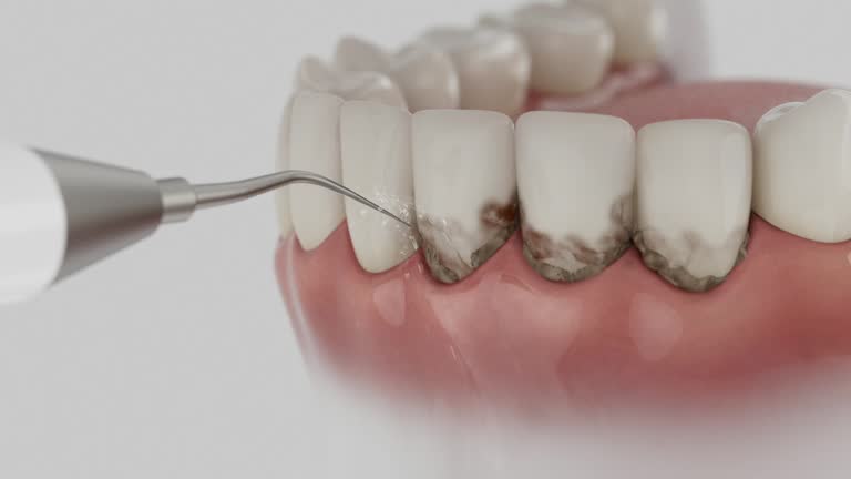 Reliable Dental contractor in Clearwater, SC by Dentist Open Now